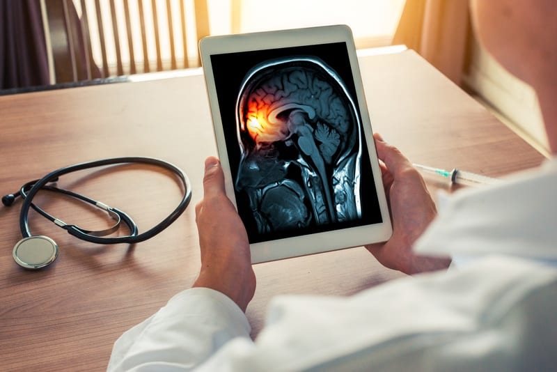 doctor looking at a patients brain scan on his tablet